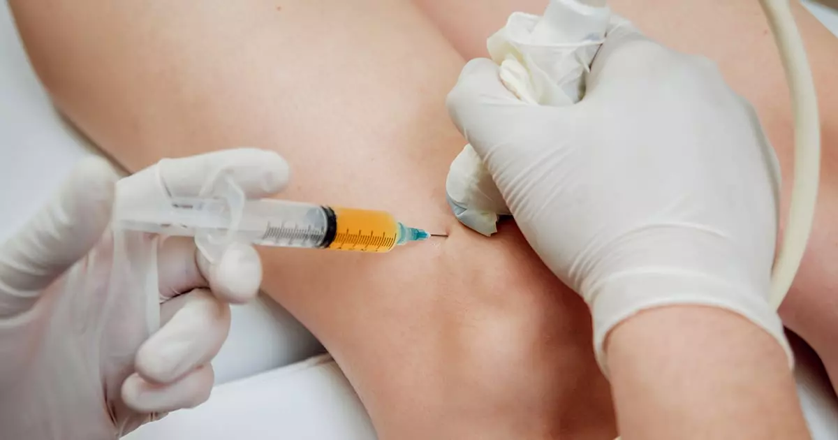 Platelet Rich Plasma (PRP) Injections