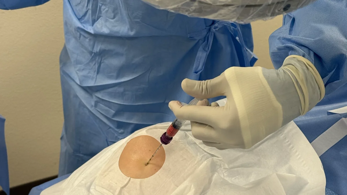 Regenerative cell therapy injection at Advanced Pain and Regenerative Specialists, Oceanside, CA