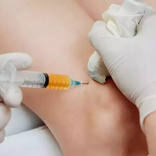 Platelet Rich Plasma (PRP) Injections